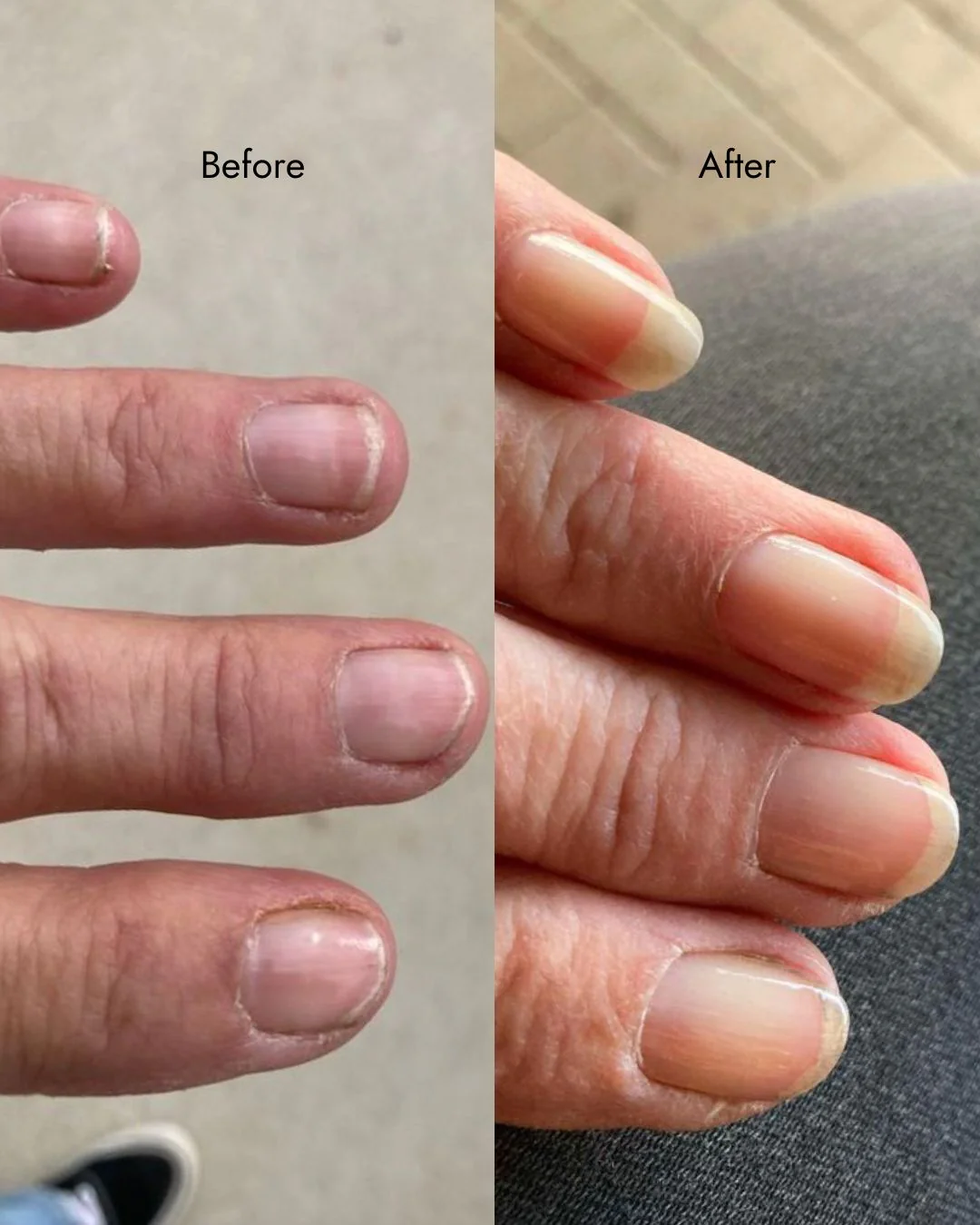 Ultimate Nail Strengthening Kit - Image 14